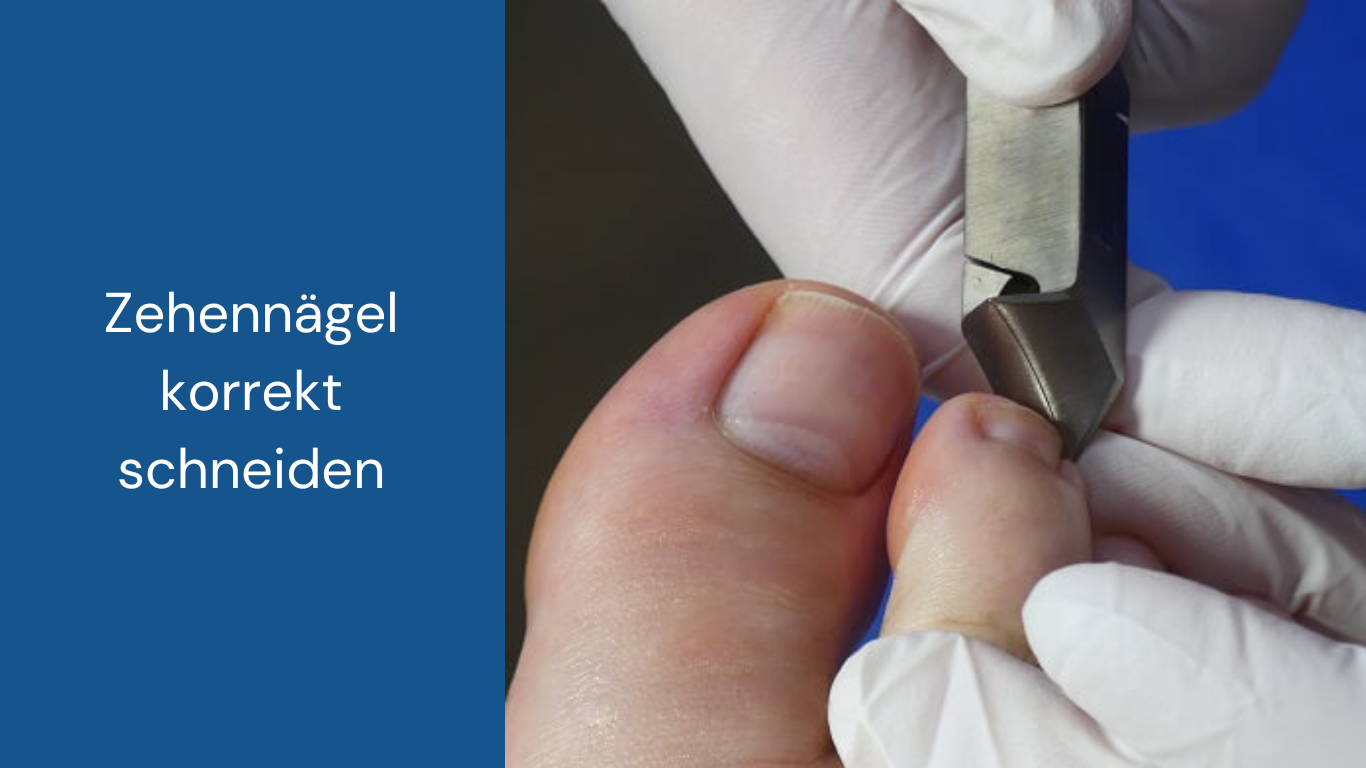 Zehennägel schneiden mit dem Kopfschneider