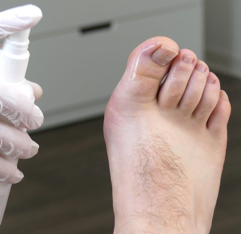 Schweißfüße behandeln mit einem Fußdeo