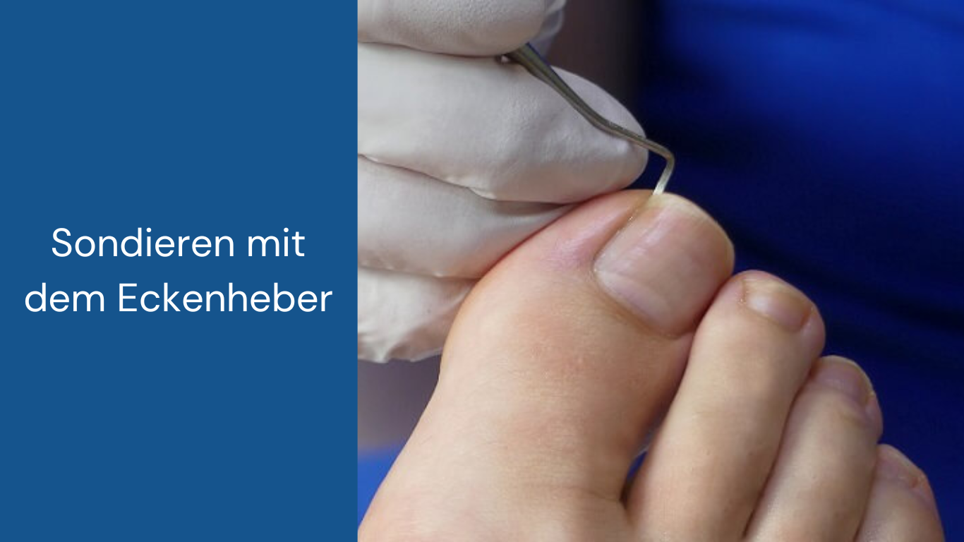 Foto und Anleitung Zehennägel schneiden