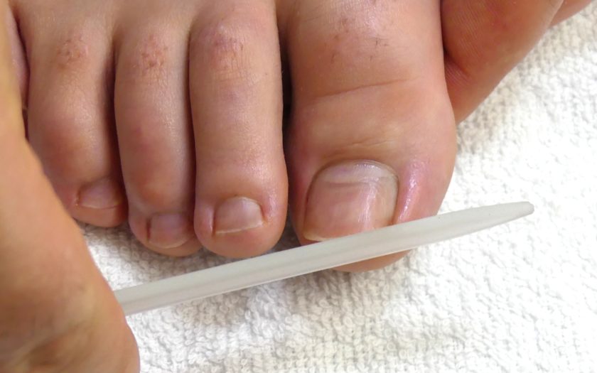 Zehennägel feilen bei der Fußpflege