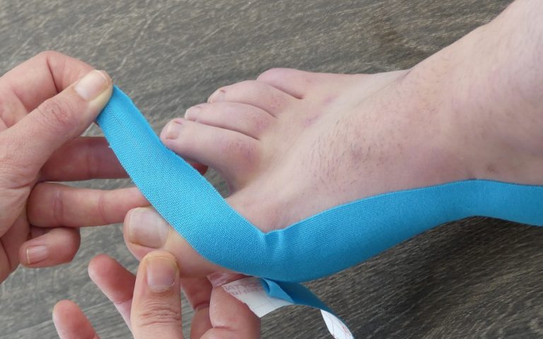 Ein Tape am Hallux Valgus anbringen