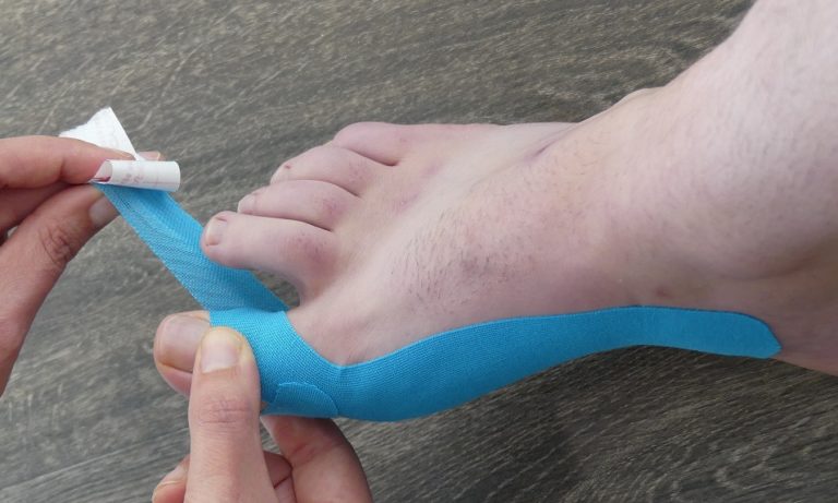 Tapen eines Hallux Valgus